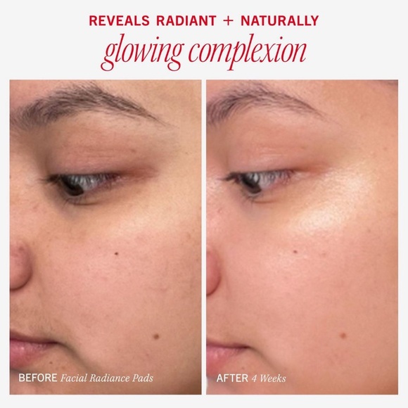 First Aid Beauty Facial Radiance Pads 60ct🪞 NEW Exfoliating Full Size - Picture 5 of 9